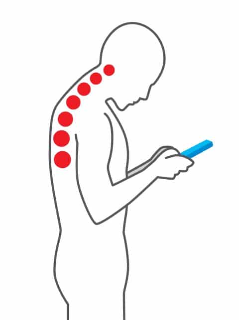 How mobile phone usage alters the spinal curve and leads to bad posture