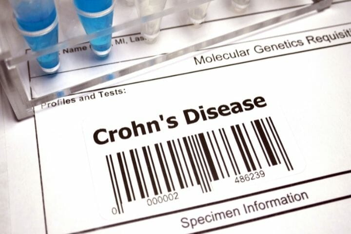 Can You Get Disability For Crohn's Disease