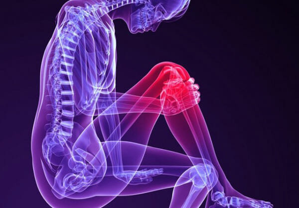 Posterior Knee Pain