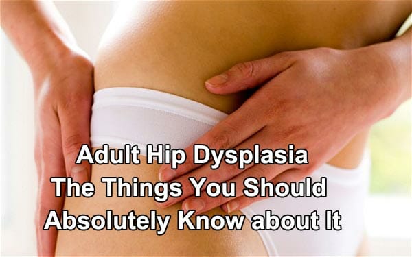 Adult Hip Dysplasia The Things You Should Absolutely Know about It