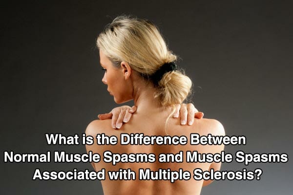 What is the Difference Between Normal Muscle Spasms and Muscle Spasms Associated with Multiple Sclerosis