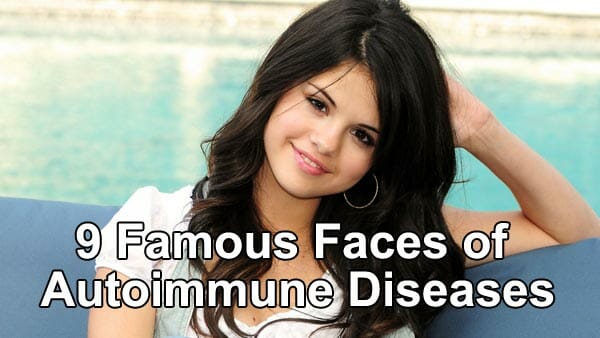 9 Famous Faces of Autoimmune Diseases