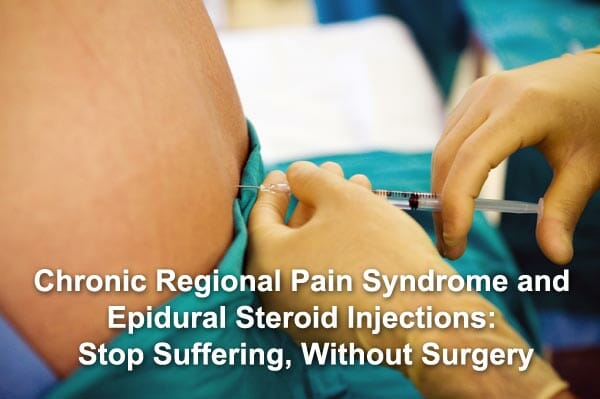 Chronic Regional Pain Syndrome and Epidural Steroid Injections: Stop Suffering, Without Surgery