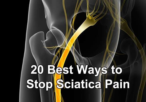 20 Best Ways to Stop Sciatica Pain