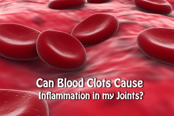 Can Blood Clots Cause Inflammation in my Joints?