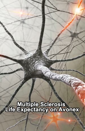 Multiple Sclerosis Life Expectancy on Avonex