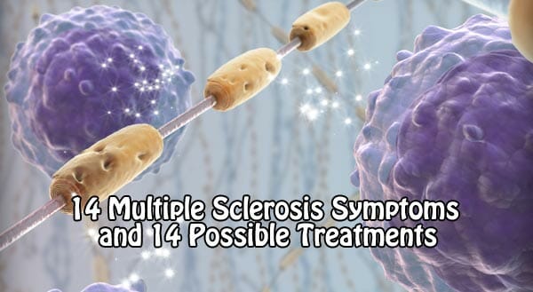 14 Multiple Sclerosis Symptoms and 14 Possible Treatments
