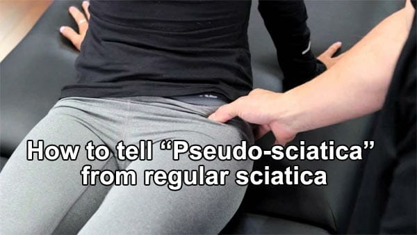Pseudo-sciatica causes