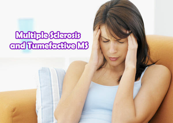 tumefactive multiple sclerosis symptoms