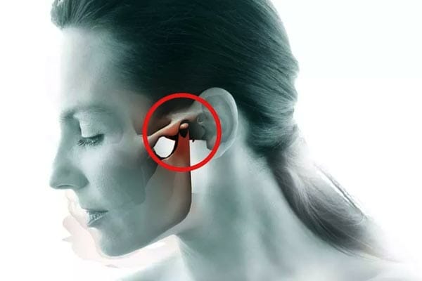 homeopathic remedies for tmj pain
