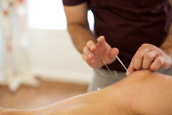 How to Choose an Acupuncturist