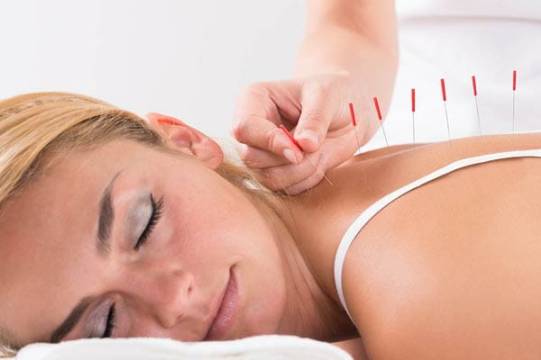 How to Choose an Acupuncturist