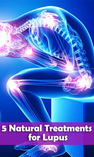 homeopathic remedies for lupus1