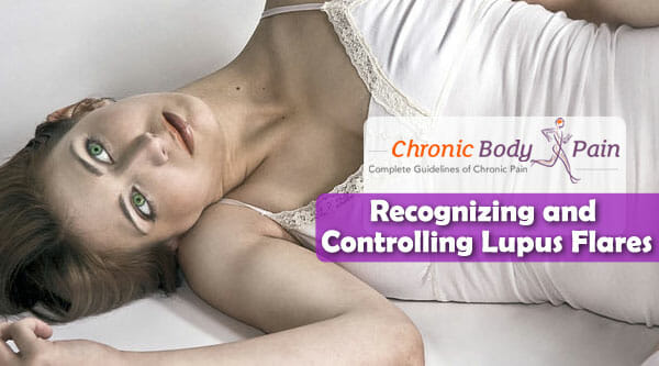 Recognizing and Controlling Lupus Flares