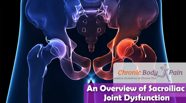 An Overview of Sacroiliac Joint Dysfunction