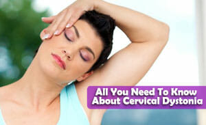 All You Need To Know About Cervical Dystonia