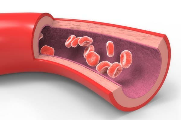 Treating Inflammation the Natural Way