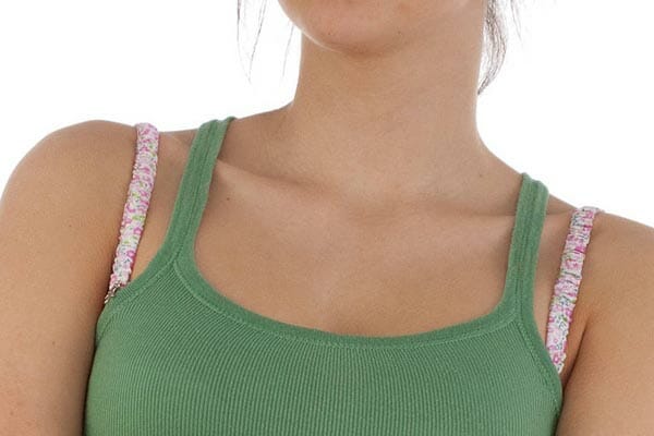 t bra strap syndrome