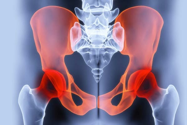 Pelvic Pain Causes and Treatments in Women and Men