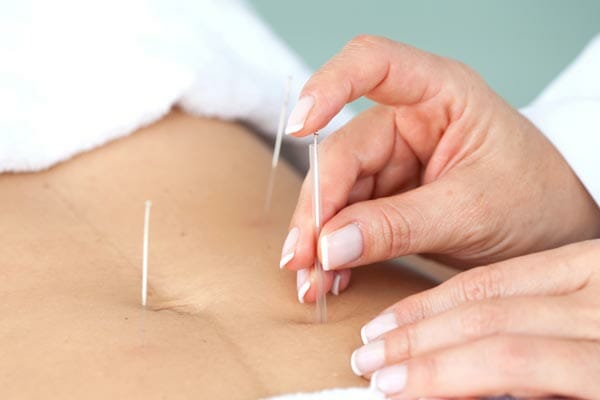 Acupuncture for kidney failure