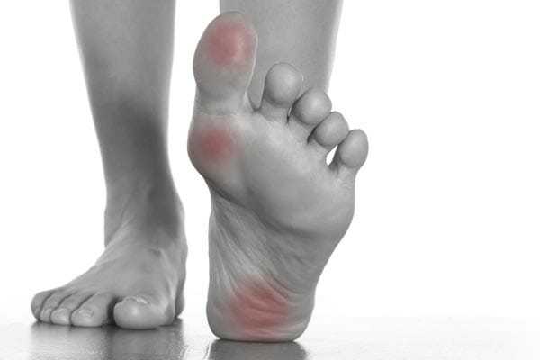 symptoms of foot pain in Rheumatoid Arthritis