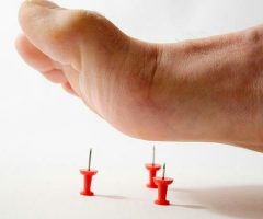 Differences Between Paresthesia and Peripheral Neuropathy
