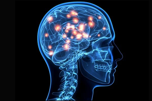 fibromyalgia neurological