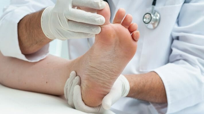 symptoms of peroneal nerve damage