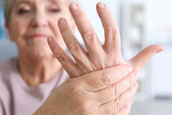 lupus and rheumatoid arthritis