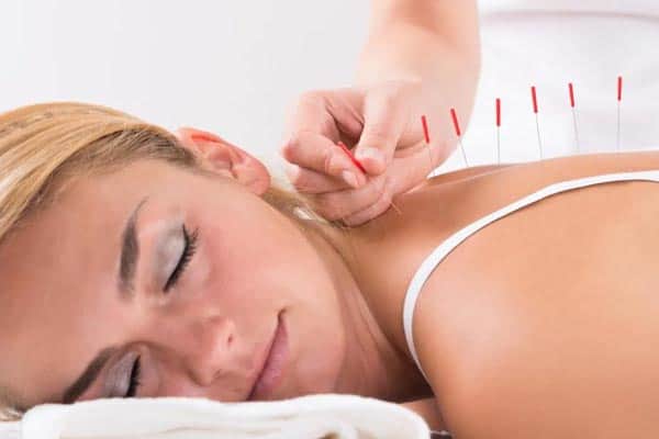 what is the difference between chinese and japanese acupuncture