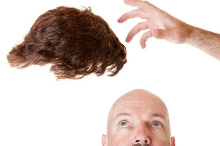 Managing Hair Loss With Age