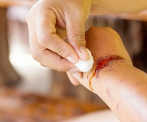 How to Care For Wounds for Elderly With Thin Skin