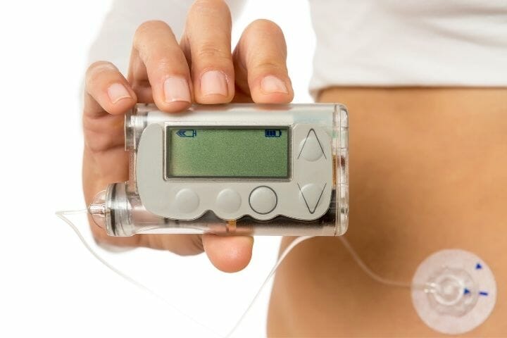 Insulin Pumps for Diabetes Patient