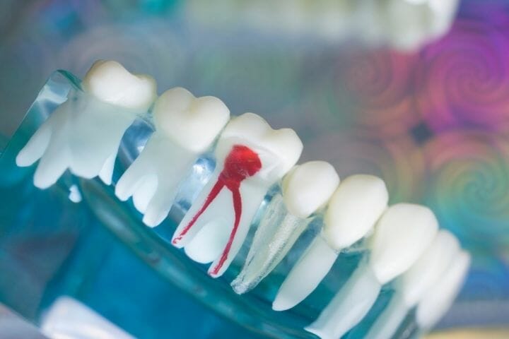 Does Gum Disease Impact the Heart?