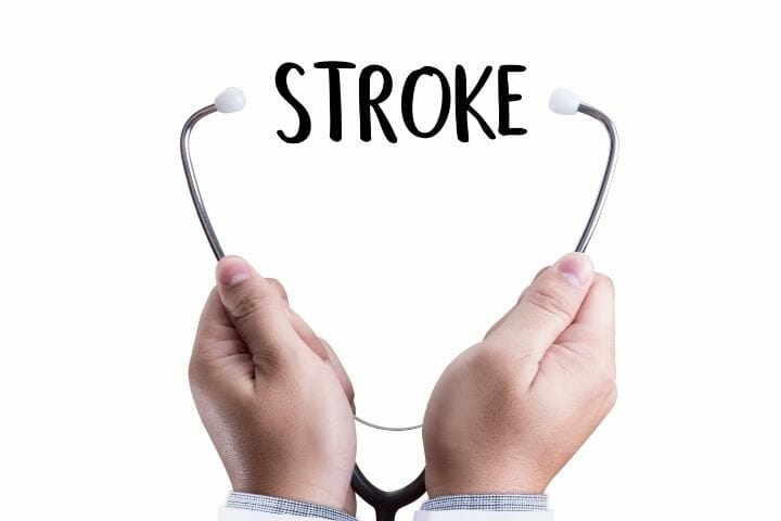 Stroke - The Complete Guide for Caregivers and Seniors