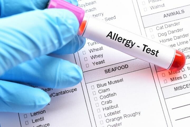 What You Need To Know About Food Allergies