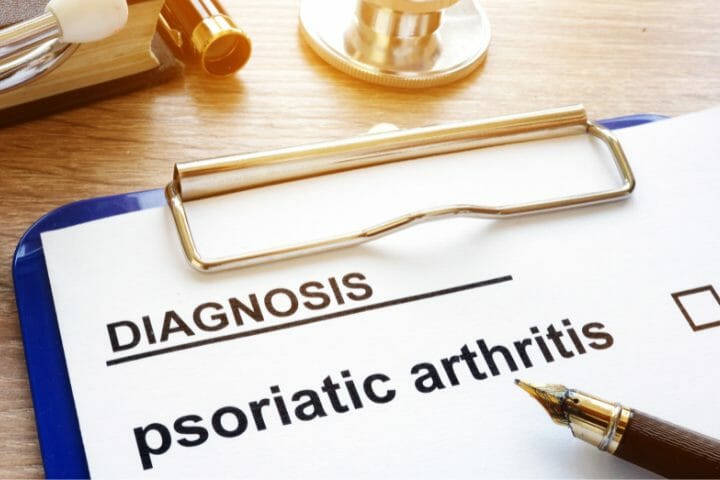 Can You Get Disability For Psoriatic Arthritis