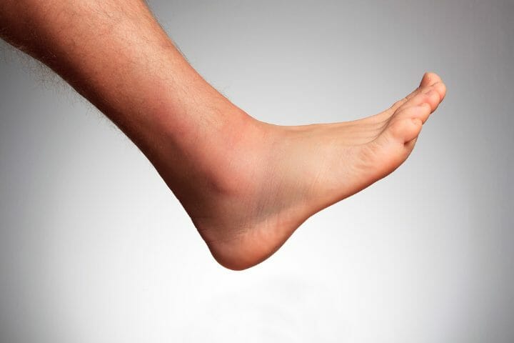 Can You Get Disability For Foot Problems