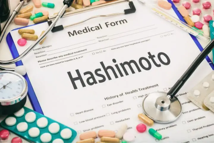 Can You Get Disability For Hashimoto's Disease