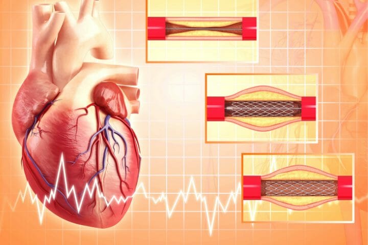 Can You Get Disability For A Blood Disorder