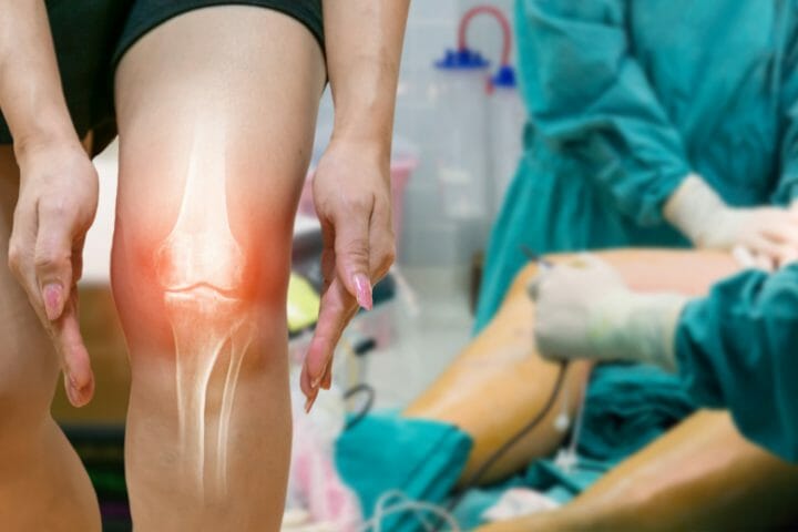 Can You Get Disability With Osteoarthritis