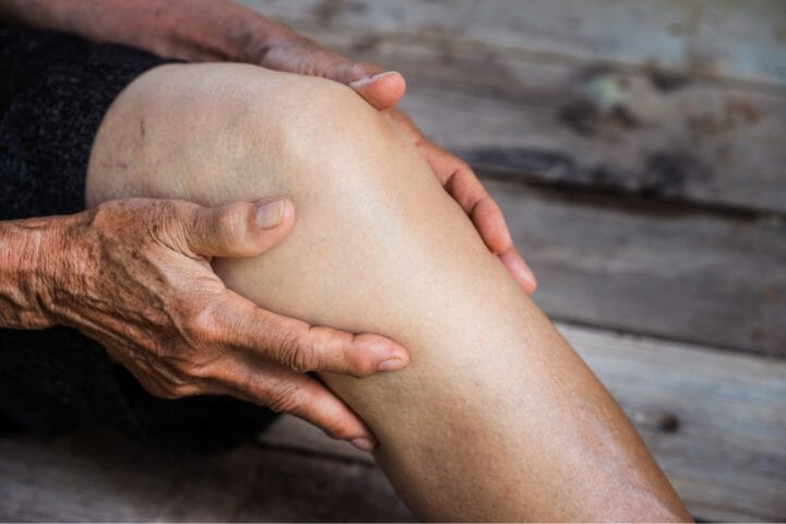 Can You Get Disability With Osteoarthritis